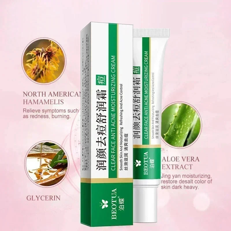 CREMA FACIAL ANTIACNE .CONTROL DE GRASA Y REPARACION