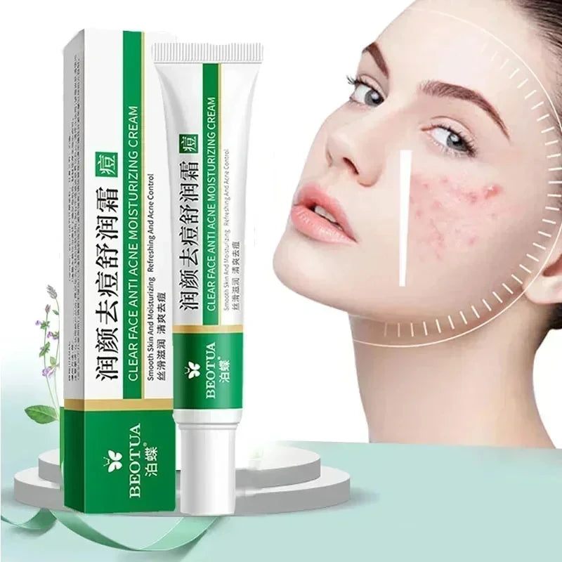 CREMA FACIAL ANTIACNE .CONTROL DE GRASA Y REPARACION